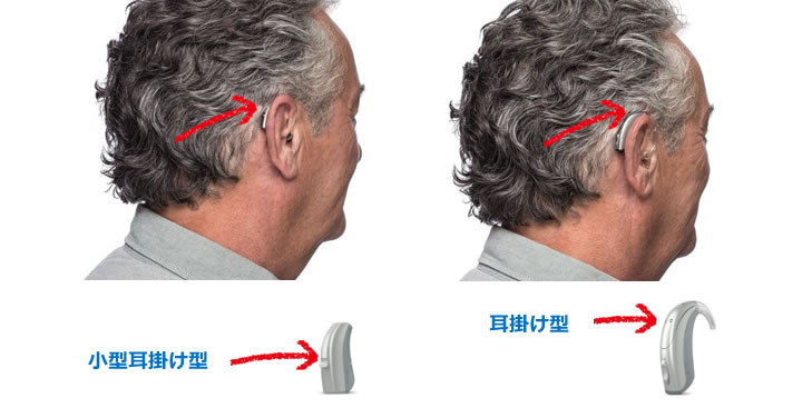 耳掛け型の補聴器