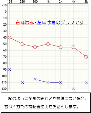 上記のように左側の聞こえが極端に悪い場合、右耳片方での補聴器使用をお勧めします。