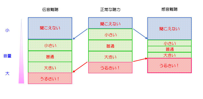 難聴によって増幅の方法が違います