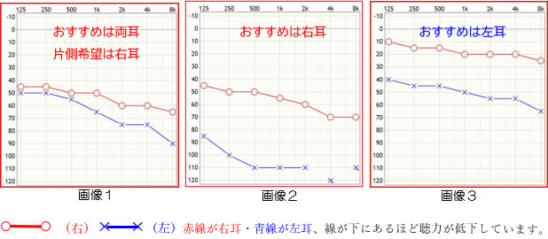 赤線が右耳・青線が左耳、線が下にあるほど聴力が低下しています。